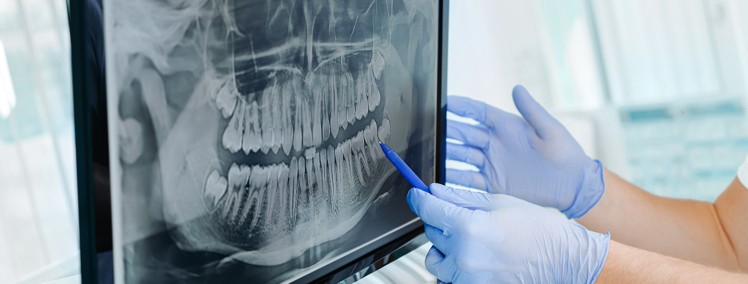 Digitale Diagnostik in der Praxis BellevueDent Goldau (Gemeinde Arth)